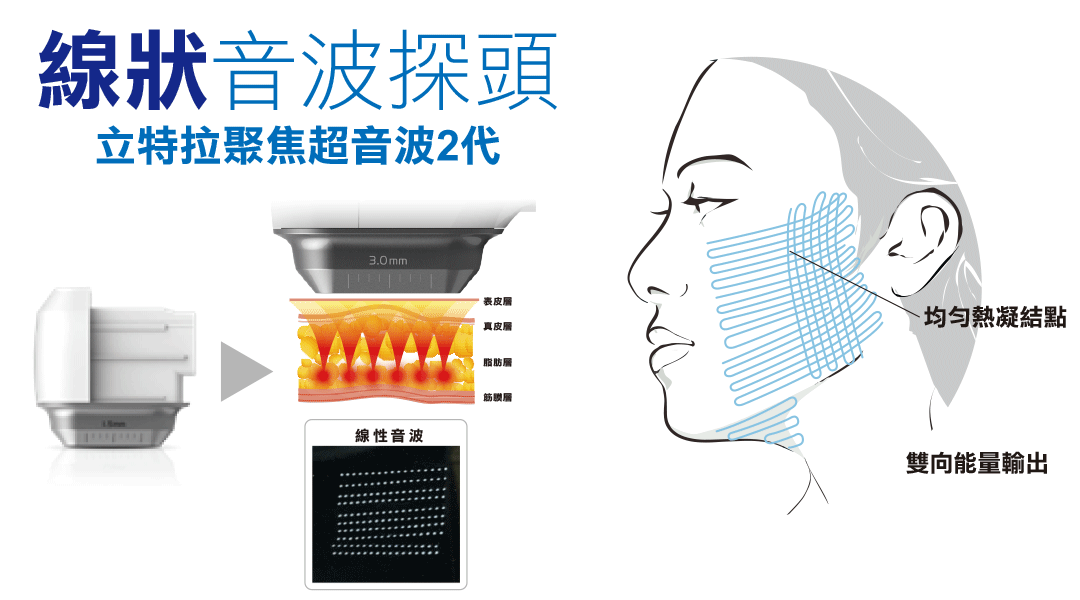 線式渦漩音波探頭介紹